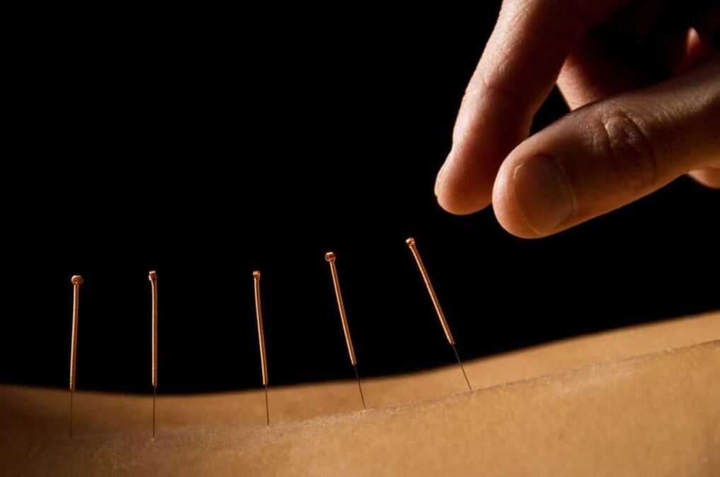 acupuntura para la prostatitis