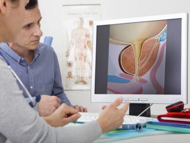 Un urólogo consulta a un paciente sobre la prostatitis y los métodos de tratamiento.